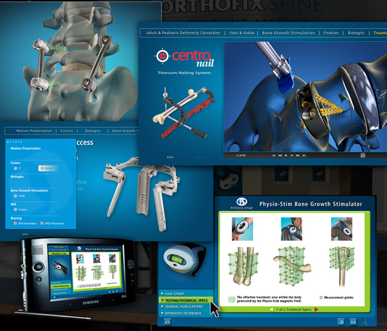 Orthofix Tradeshow Interactive Monitor Presentation Design and Development
