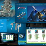 Orthofix Tradeshow Interactive Monitor Presentation Design and Development